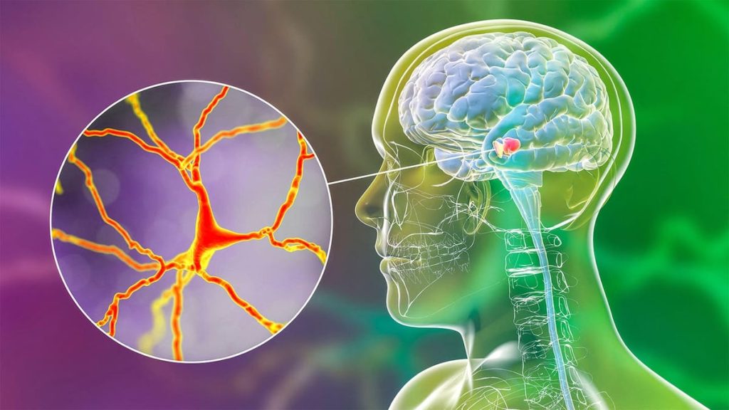 Trendy Longevity Supplement Misses the Mark in Parkinson’s Trial