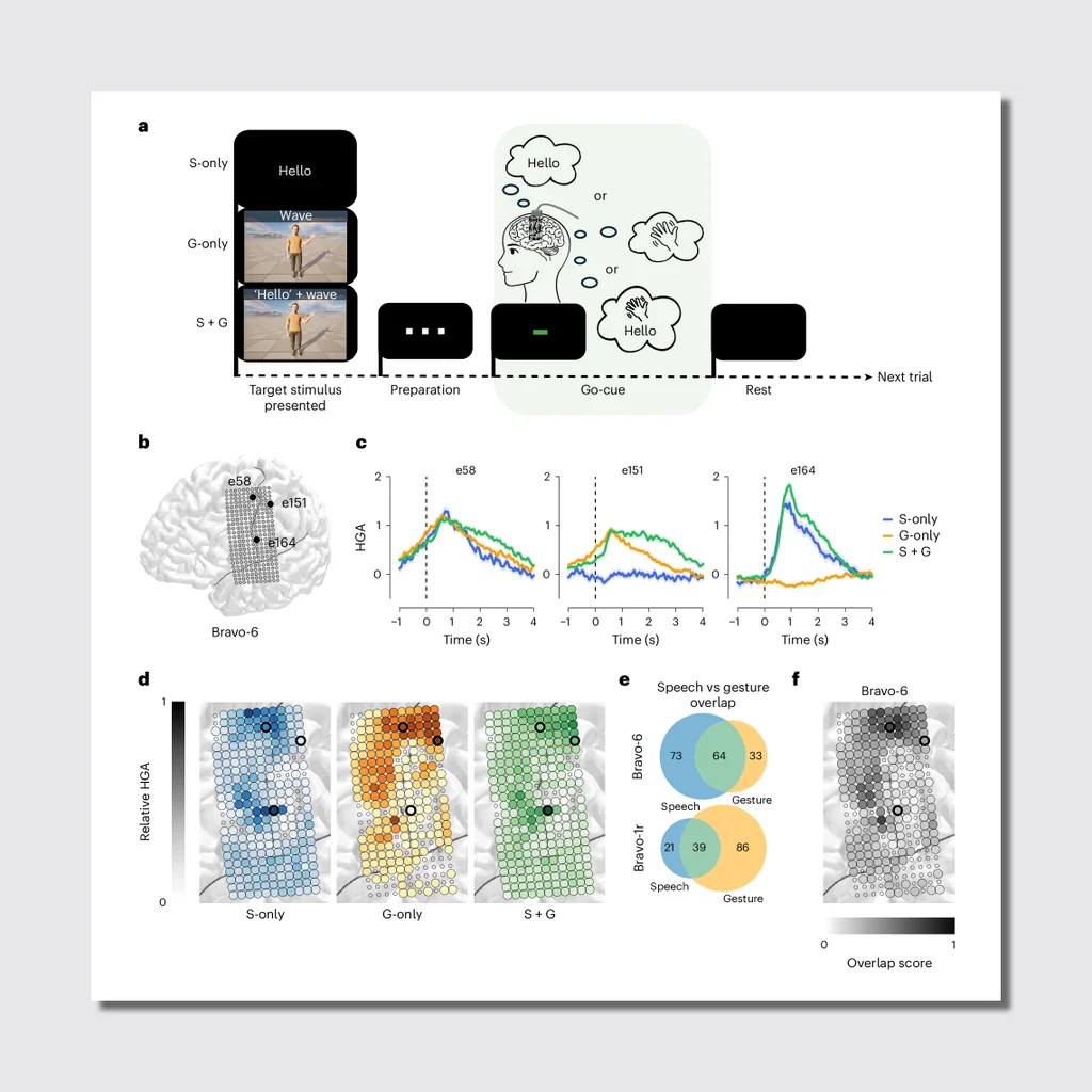 This AI-powered brain implant hints at the future of human interaction